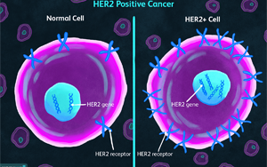 《自然醫(yī)學(xué)》：一種可以顯著延長(zhǎng)乳腺癌患者生命的新藥