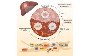 肝癌免疫治療成功的生物標(biāo)志物