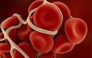 胃蛋白酶原II（PGII）-磁微粒化學發(fā)光法（AE/AP）/熒光免疫層析解決方案（含保護劑評估）