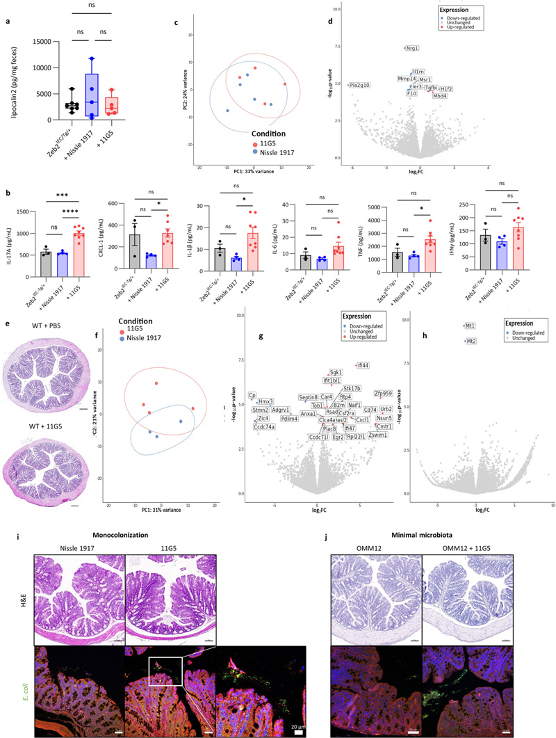 
大腸桿菌11G5感染不會(huì)增加Zeb2 IEC-Tg/+小鼠的結(jié)腸炎癥，也不會(huì)影響WT同窩小鼠的上皮細(xì)胞