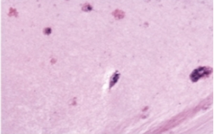 支原體清除試劑：解決細(xì)胞培養(yǎng)中支原體污染問(wèn)題的利器