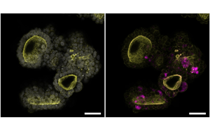 Cell：突破類(lèi)器官研究限制！利用所有關(guān)鍵的胰腺細(xì)胞創(chuàng)造了一個(gè)新的類(lèi)器官