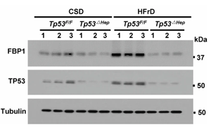 《Nature》脂肪肝為什么會導致肝癌？