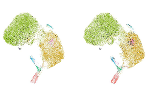 科學家發(fā)現(xiàn)了一種新的癌癥免疫治療靶點：功能失調(diào)的B細胞