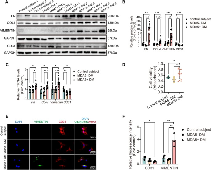 MDA5陽性皮肌炎患者血清可誘導原代小鼠肺微血管內皮細胞發(fā)生內皮-間質轉化 MDA5陽性皮肌炎患者血清可誘導原代小鼠肺微血管內皮細胞發(fā)生內皮-間質轉化