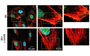 S-亞硝基化修飾 EZH2：調控內皮穩(wěn)態(tài)的新機制與潛在治療靶點