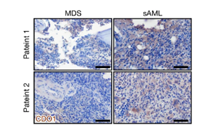 Nature：?；撬崮芡苿?dòng)白血病癌細(xì)胞生長(zhǎng)！
