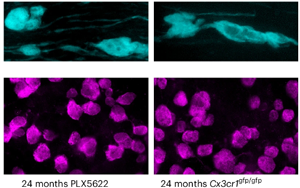《Nature Neuroscience》大腦白質(zhì)為何隨年齡退化？因?yàn)槊庖呒?xì)胞“勾心斗角”