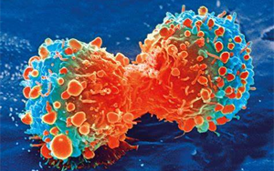 Nature Genetics：腫瘤轉(zhuǎn)移過程中會(huì)積累更多的拷貝數(shù)變異，而不是突變