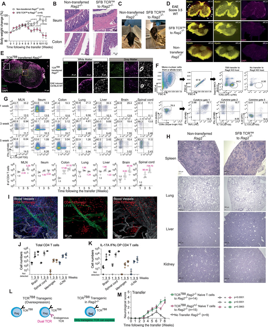 轉(zhuǎn)移的TCR7B8 CD4 T細(xì)胞在腸道和中樞神經(jīng)系統(tǒng)中擴(kuò)增并展現(xiàn)致病活性 轉(zhuǎn)移的TCR7B8 CD4 T細(xì)胞在腸道和中樞神經(jīng)系統(tǒng)中擴(kuò)增并展現(xiàn)致病活性