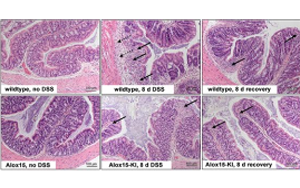 ALOX15功能人源化通過提升RvD5生成緩解小鼠結(jié)腸炎但不影響足爪水腫的機制研究