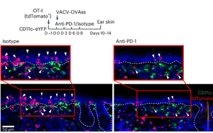 PD-1通過(guò)TGFβ信號(hào)通路調(diào)控皮膚組織駐留記憶T細(xì)胞（TRM）形成與功能分化的機(jī)制研究