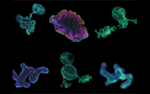 藥物研發(fā)的未來(lái)——類(lèi)器官技術(shù)