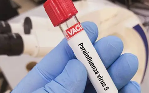 副流感病毒（HPIV1、2、3型）抗原檢測-免疫層析 （膠體金、彩色乳膠及熒光免疫層析）解決方案