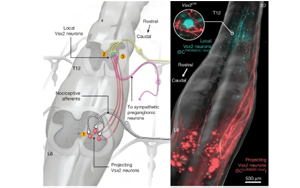 揭示自主神經(jīng)反射異常（AD）的神經(jīng)元架構(gòu)：脊髓損傷后惡性高血壓發(fā)作的機(jī)制與神經(jīng)調(diào)控治療新策略