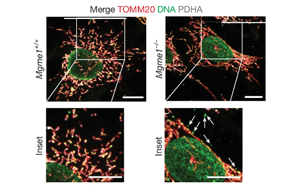 核糖核苷酸滲入線粒體DNA驅(qū)動炎癥反應——揭示核苷酸代謝失衡引發(fā)年齡相關(guān)性炎癥的新機制