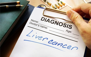 原發(fā)性肝癌檢測(cè)用AFU底物(CNP-AFU和M-G-CNP-AFU)