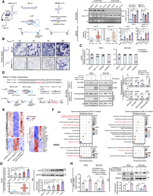 前列腺癌中tRNALeuTAA來(lái)源的小RNA tRF-21的鑒定、表征及其靶基因研究
