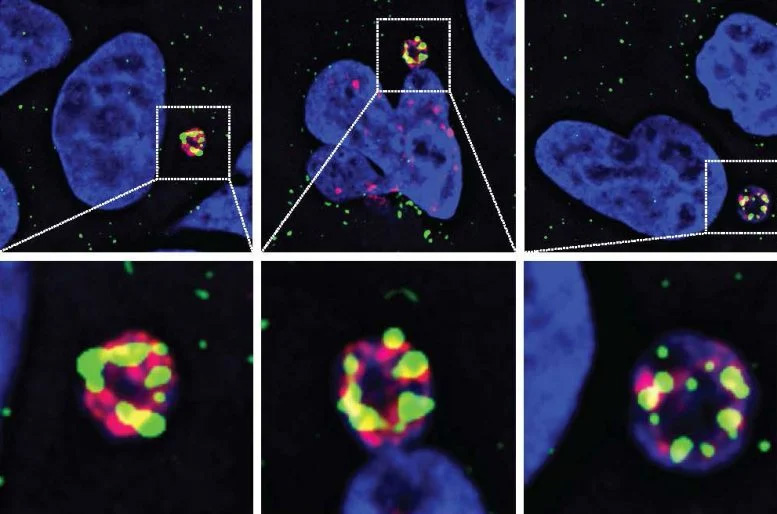 N4BP2酶(綠色)滲入微核并在其中引發(fā)DNA損傷(紅色) N4BP2酶(綠色)滲入微核并在其中引發(fā)DNA損傷(紅色)