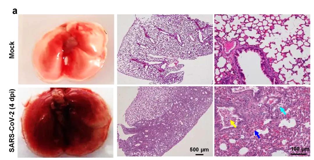 ?建模成功！Nature子刊：成功建立新冠肺炎重癥模型，揭示新冠病毒感染的分子機制