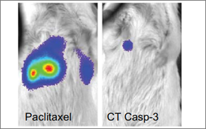 Nature子刊：用細(xì)菌遞送藥物到癌細(xì)胞內(nèi)，有效治療肝癌和乳腺癌