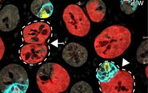 Nature 三連重磅！識(shí)破癌細(xì)胞的“詭計(jì)”，為結(jié)直腸癌患者帶來(lái)新希望