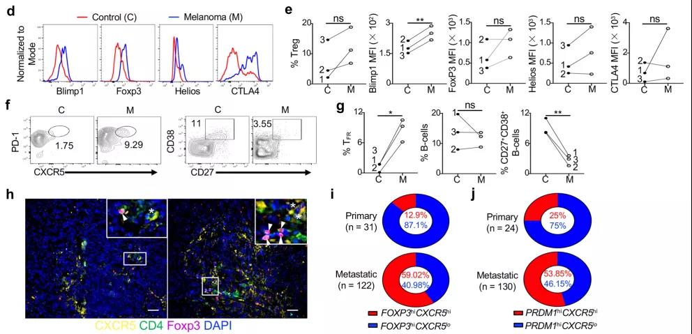 如何重塑腫瘤微環(huán)境，強(qiáng)化抗PD-1療效？Treg細(xì)胞的Blimp1表達(dá)是關(guān)鍵！