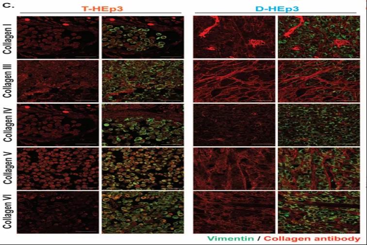 讓癌細(xì)胞“一睡不醒”！向腫瘤微環(huán)境中添加III型膠原蛋白可防止腫瘤復(fù)發(fā)和轉(zhuǎn)移