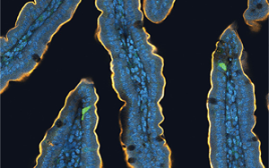 喝完無(wú)糖飲料還想吃甜食？人們對(duì)糖的渴望，無(wú)法被甜味劑替代，答案都在腸道里！