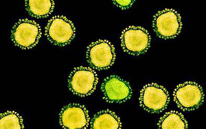 傳播速度快！新變體BA.2.12.1“風(fēng)靡”北美