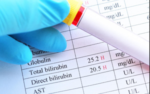 總膽紅素/直接膽紅素檢測(cè)一站式解決方案