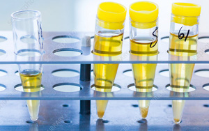 尿液分析試紙檢測(cè)原理及產(chǎn)品推薦