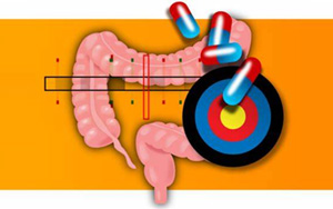 《Nature Genetics》確定10個(gè)克羅恩病相關(guān)基因