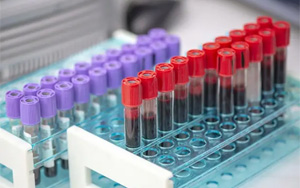 膽堿酯酶（CHE）檢測(cè)原料一覽