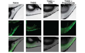 環(huán)境中的化學物質(zhì)會增加炎癥性腸病的風險