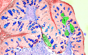 Nature新研究解答爭(zhēng)議，為炎癥性疾病的免疫機(jī)制提供新見(jiàn)解