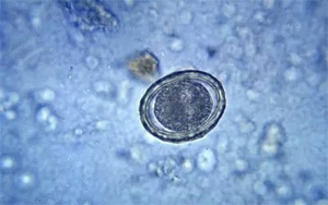 讓培養(yǎng)皿“患上”P(pán)TSD，然后為人類(lèi)拓寬治療手段