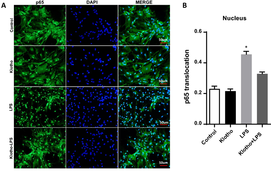 α-Klotho挽救核心區(qū)域由LPS誘導(dǎo)的NF-κB活化 α-Klotho挽救核心區(qū)域由LPS誘導(dǎo)的NF-κB活化