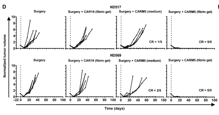 纖維蛋白凝膠中的CAR-T細胞在TNBC異種移植模型中有效清除術(shù)后殘留腫瘤細胞 纖維蛋白凝膠中的CAR-T細胞在TNBC異種移植模型中有效清除術(shù)后殘留腫瘤細胞