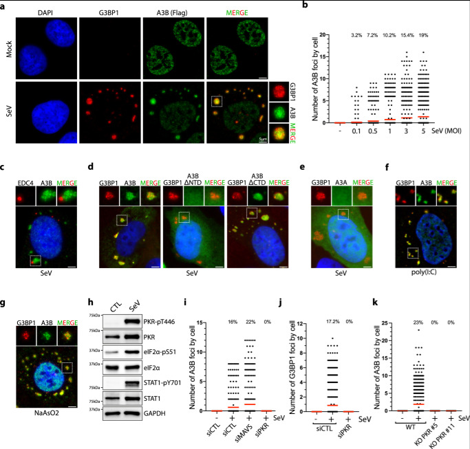 SeV感染誘導APOBEC3B定位于應(yīng)激顆粒