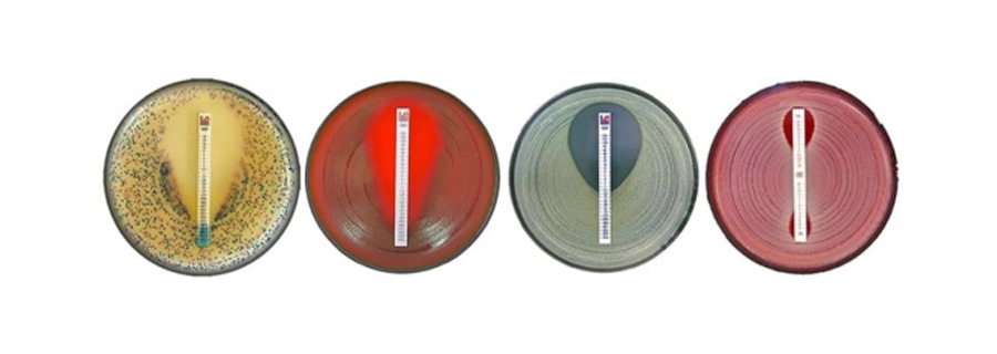 藥敏檢測(cè) 藥敏檢測(cè)