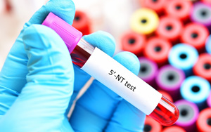 5'-核苷酸酶（5'-NT）檢測試劑盒用原輔料