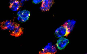 《Nature Immunology》兩種不同類型的免疫細(xì)胞幫助20億人控制結(jié)核病