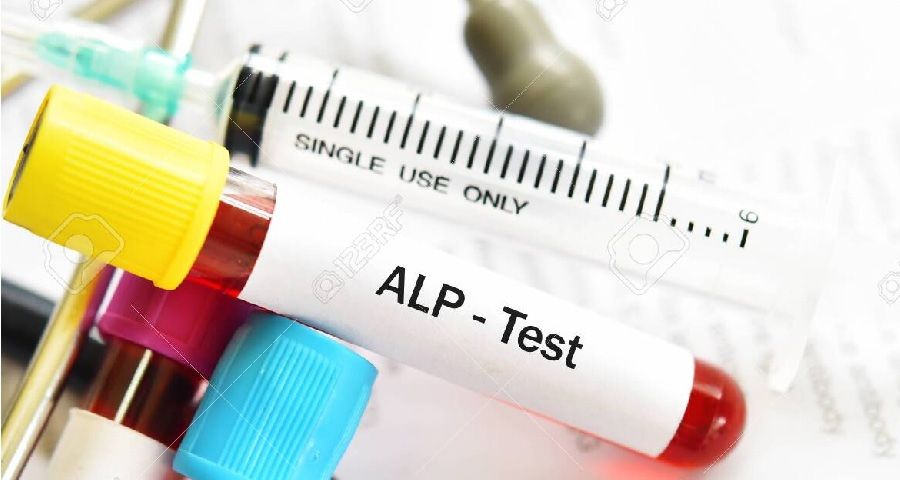 堿性磷酸酶檢測 堿性磷酸酶檢測