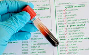 谷氨酸脫氫酶（GLDH/GDH）檢測試劑盒用原輔料