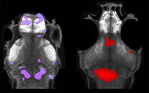 自閉癥相關(guān)基因集中在小膠質(zhì)細(xì)胞和多巴胺上
