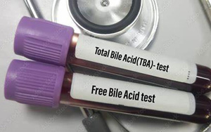 總膽汁酸（TBA）檢測試劑盒用原輔料