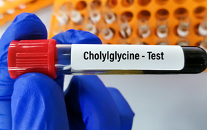 甘膽酸（CG）檢測試劑盒用原輔料