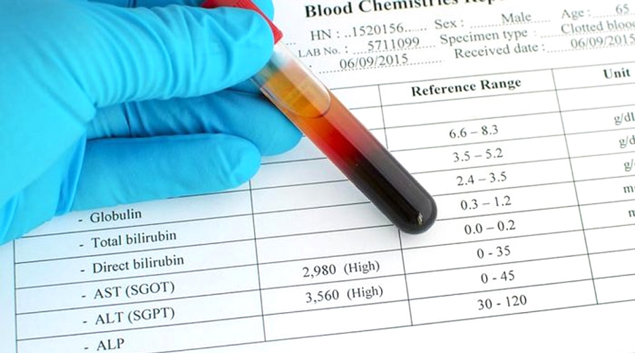 谷丙轉(zhuǎn)氨酶(ALT)檢測 谷丙轉(zhuǎn)氨酶(ALT)檢測