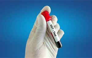 γ-谷氨酰轉移酶（γ-GT）檢測試劑盒用原輔料